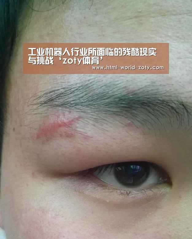工业机器人行业所面临的残酷现实与挑战‘zoty体育’(图1) 中欧体育